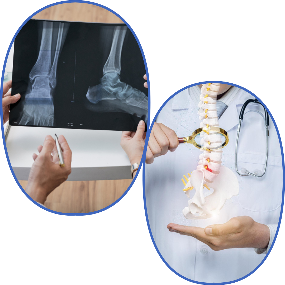 Ortopedista infantil Cuautitlán Izcalli